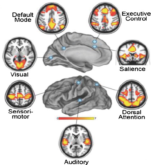 brain networks revealed by resting state functional connectivity mri .jpg